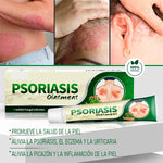PSORIASIS™ Crema Antifúngica y Antipicazón | 20g ☀️
