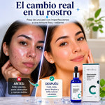 NeoCell Serum | Menos imperfecciones, más confianza en tu piel