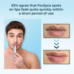 Belani-Fordyce® Despídete de las manchas en tus labios💋