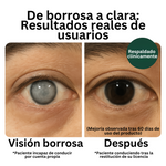 Zoone™ No más pérdida visual + envío gratis