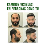 OFERTA 2x1 CRECE CABELLO 🌱✨REDUCTOR DE CAÍDA+ENVÍO GRATIS⭐