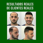 OFERTA 2x1 CRECE CABELLO 🌱✨REDUCTOR DE CAÍDA+ENVÍO GRATIS⭐